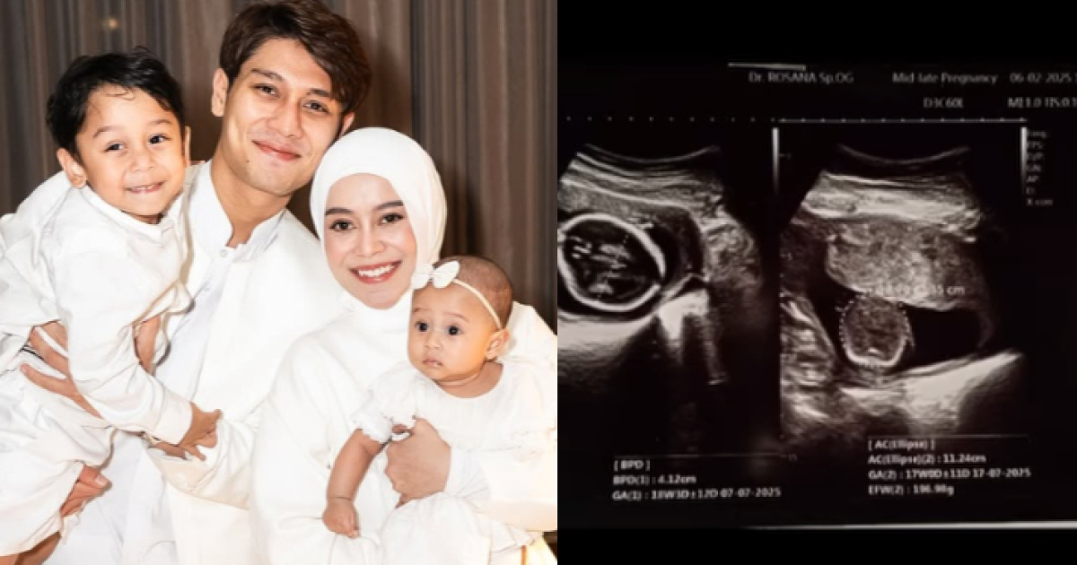 Selamat! Lesti Kejora Hamil Anak Ketiga, Rizky Billar Ungkap Rasa Syukurnya