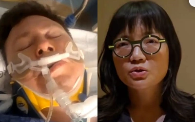 Prof Bartek Suami Wamen Prof Stella Kecelakaan Ski, Aorta Pecah, Tulang Patah