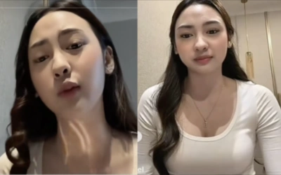 Pakai Whip Pink, BTR Rachel Akui Tak Rasakan Efek Samping