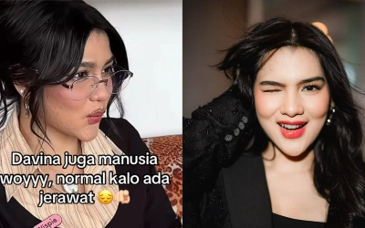 Respons Davina Karamoy Saat Wajah Berjerawatnya Dikaitkan dengan Ain