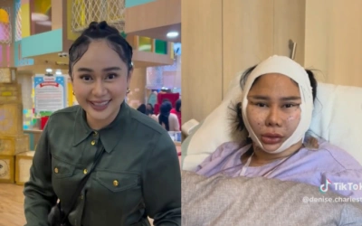 Denise Chariesta Oplas Usai Flamingo Era, sang Selebgram: Muka Satu Miliar