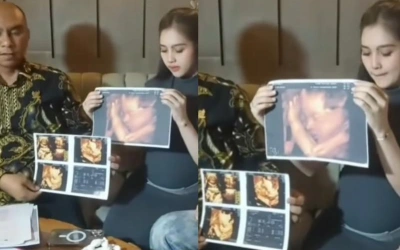 Friceilda Prillea Spill Hasil USG Diduga Anak Anrez Adelio, Jenis Kelamin Terungkap!