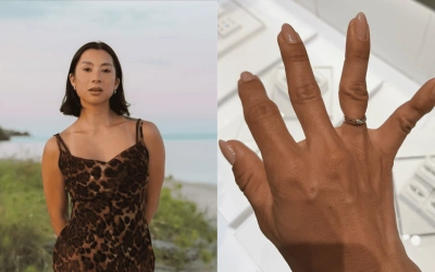 Insiden Ngeri Jennifer Bachdim, Cincin Nikah Dipotong Damkar!