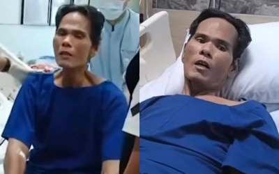 Fahmi Bo Jalani Operasi Batu Empedu, Wajahnya Kini Jadi Sorotan!