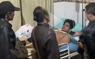 Irmanda Vokalis Band Hardcore Dibacok OTK Saat Konser Musik Underground di Kota Batu