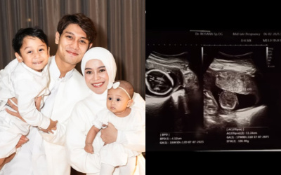 Selamat! Lesti Kejora Hamil Anak Ketiga, Rizky Billar Ungkap Rasa Syukurnya