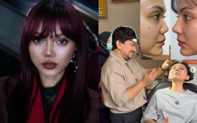 Rina Nose Operasi Plastik, Ungkap Alasan Rombak Bentuk Hidungnya di Dokter Tompi