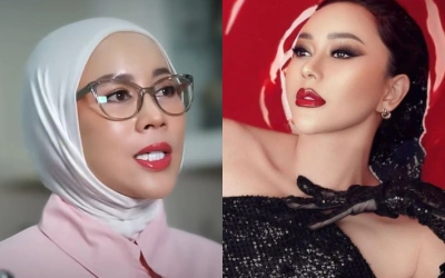Wajah Shanty Denny Berubah, Disebut Mirip Aura Kasih hingga Melly Goeslaw!