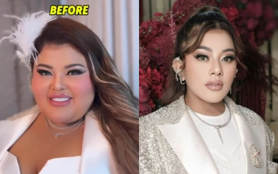 Sukses Turunkan Berat Badan 69Kg, Intip Potret Shindy Samuel yang Bikin Pangling