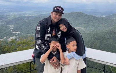 Virgoun Tunjukkan Potret Starla Usai Hilangkan Tanda Lahir, Netizen Puji Mantan Inara Rusli