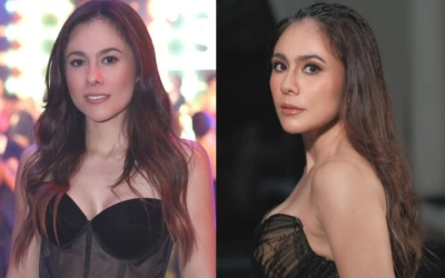 Kondisi Wajahnya Dinyinyiri, Wulan Guritno Akui Pernah Merasa Insecure!