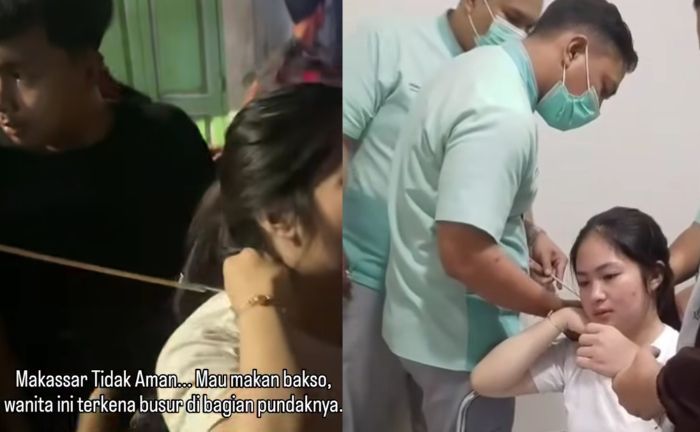 Ngilu! Detik-detik Pencabutan Anak Panah yang Nyasar ke Pundak Perempuan di Makassar