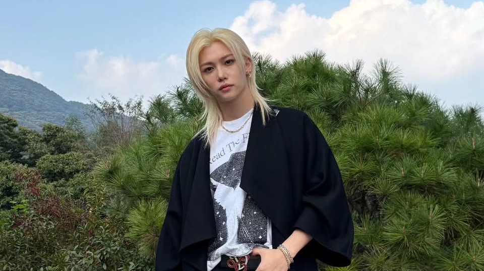 Felix Stray Kids Patah Tulang Akibat Kecelakaan Mobil