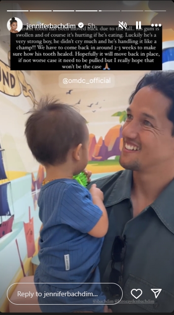 Anak Jennifer Bachdim Jatuh Dari Tangga, Lukanya Cukup Parah