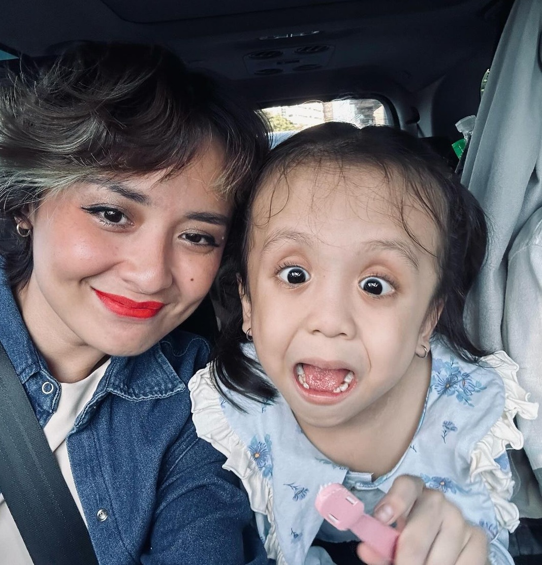 Hidung Anaknya Kemasukkan Kacang Hijau, Joanna Alexandra Pontang-panting Cari RS