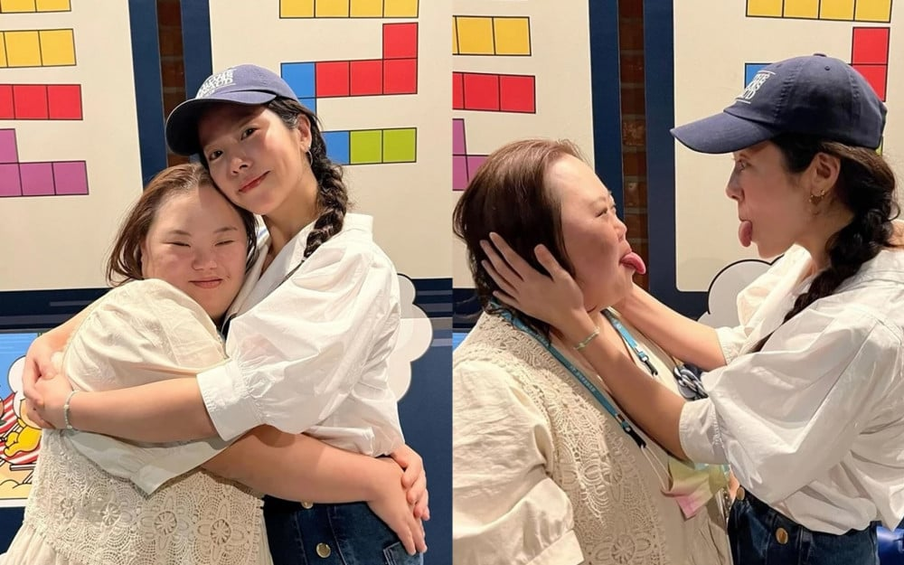 Aktris Down Syndrome Jung Eun Hye Bakal Nikah Mei Ini