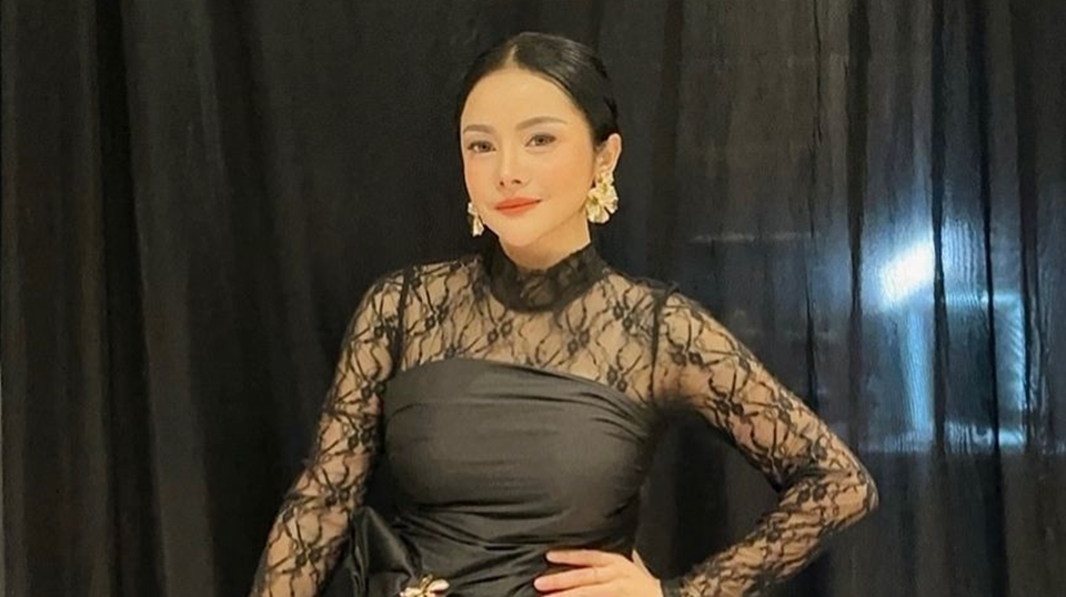 Mawar AFI yang Habiskan Setengah Miliar Buat Oplas, Intip 5 Potret Cantiknya