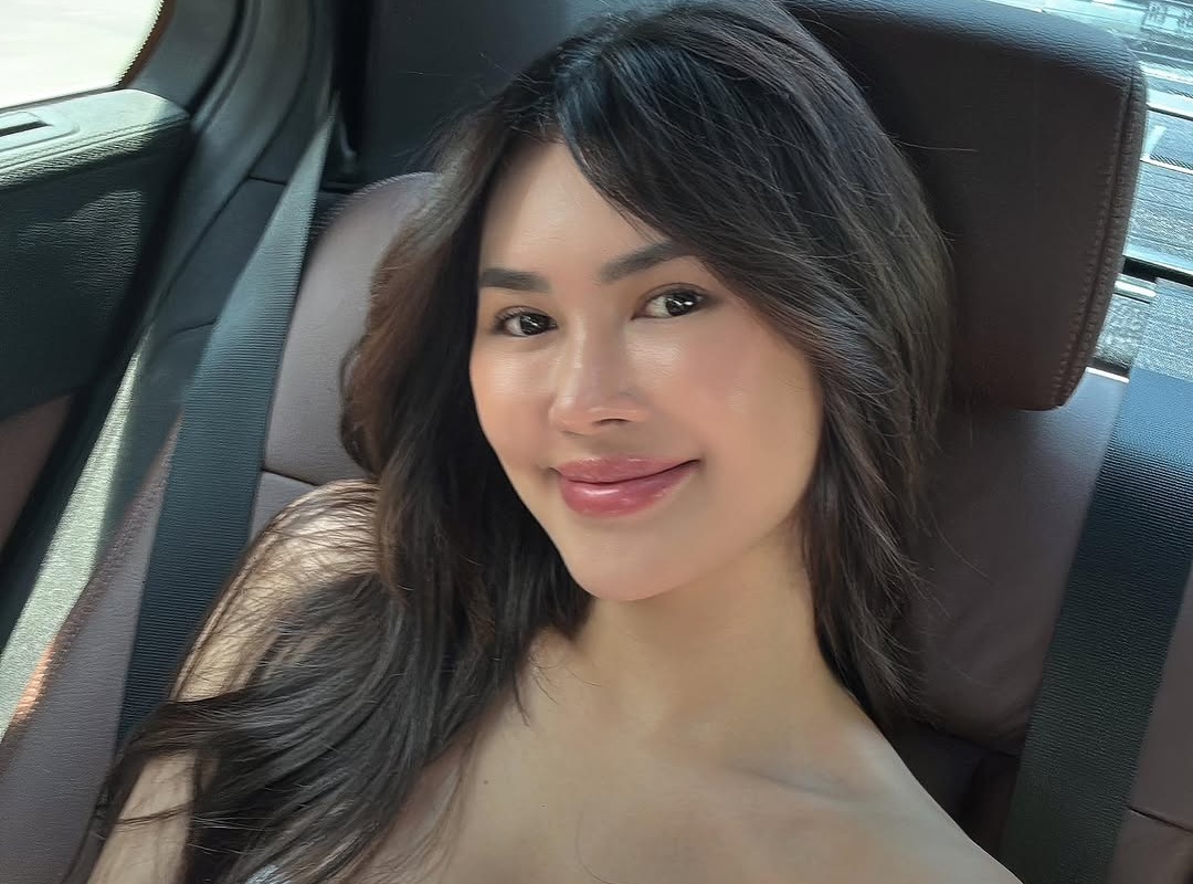 Influencer Michelle Halim Rogoh Rp300 Juta Buat Veneer Gigi di Thailand