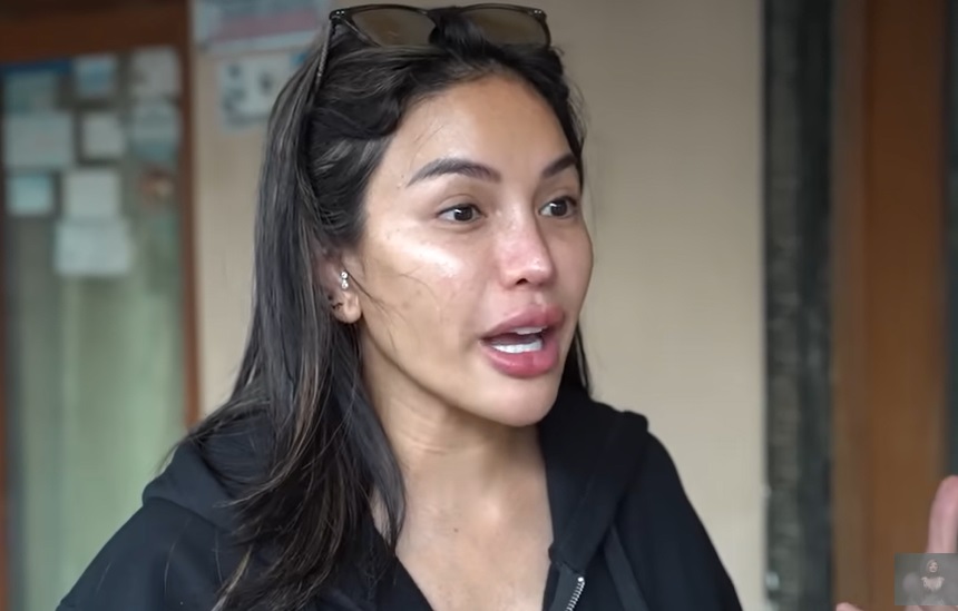 Nikita Mirzani Heran Artis Oplas Hidung Pakai Alasan Sinus, Sindir Mahalini & Rizky Febian?