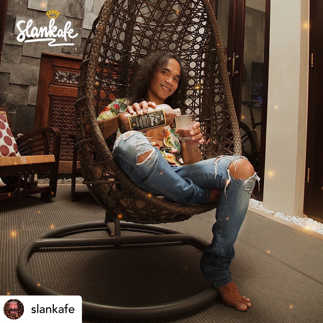 Kaka Slank Transplantasi Rambut Demi Penampilan