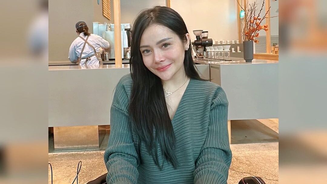 Mawar AFI Serasa Makin Muda Usai Oplas Hidung Rp70 Juta di Korea