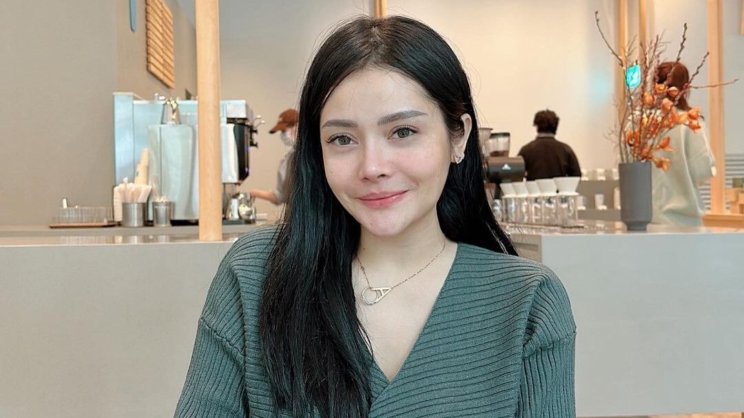 Oplas Hidung 20 Tahun Lalu, Mawar AFI Rogoh Kocek Rp200 Juta