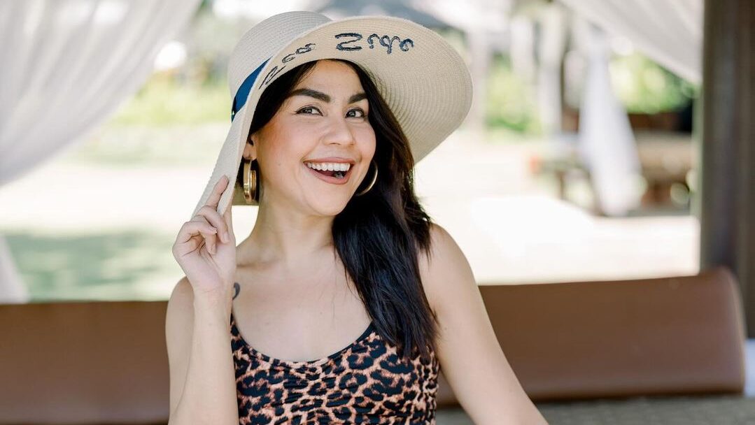 Biar Makin Mancung, Melaney Ricardo Pertimbangkan Operasi Plastik