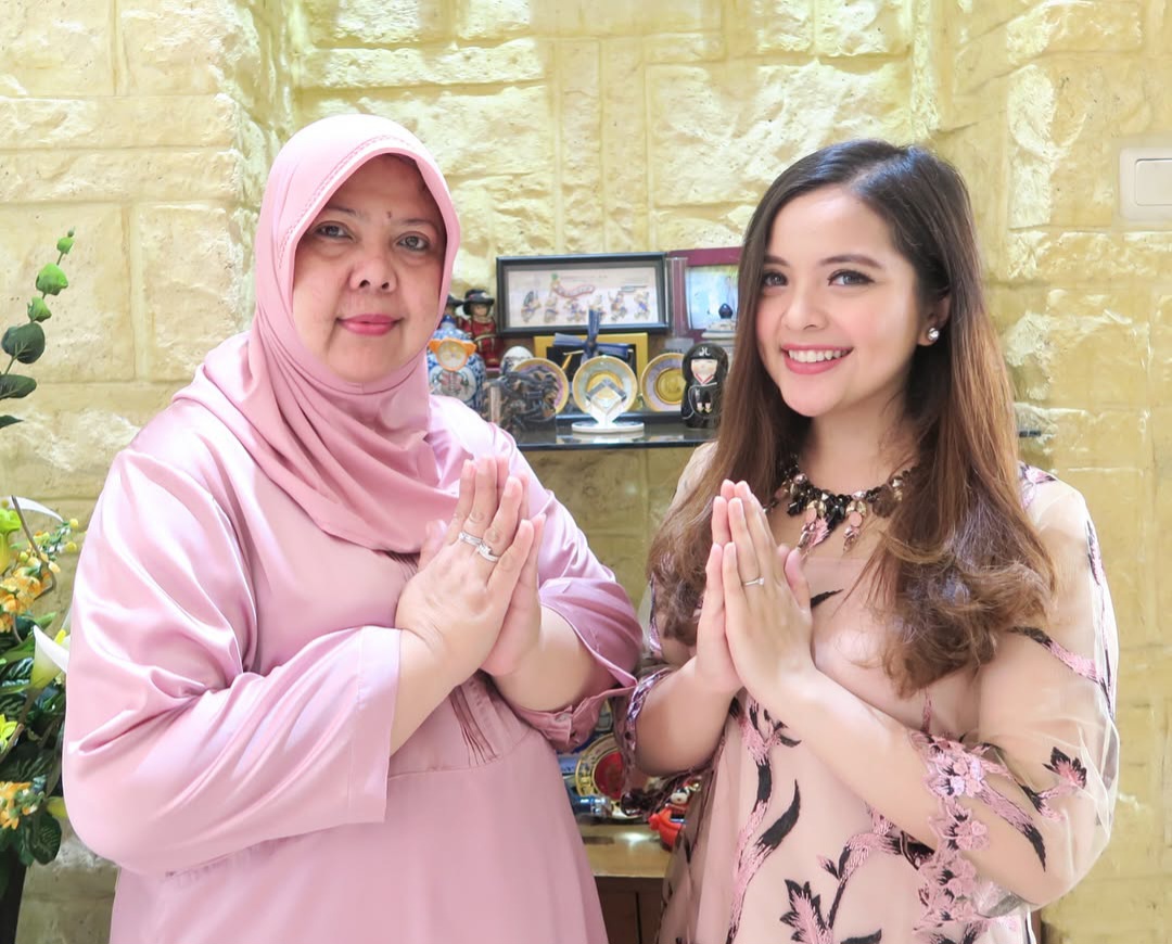 Diet Jalur Operasi Bariatrik Sukses, Ibunda Tasya Kamila Turun BB 7 Kg dalam Seminggu