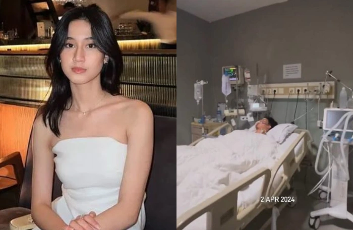 Kondisi adik Keiysa Levronka setelah jatuh dari Lantai 6 Kampus Untar. [Instagram]