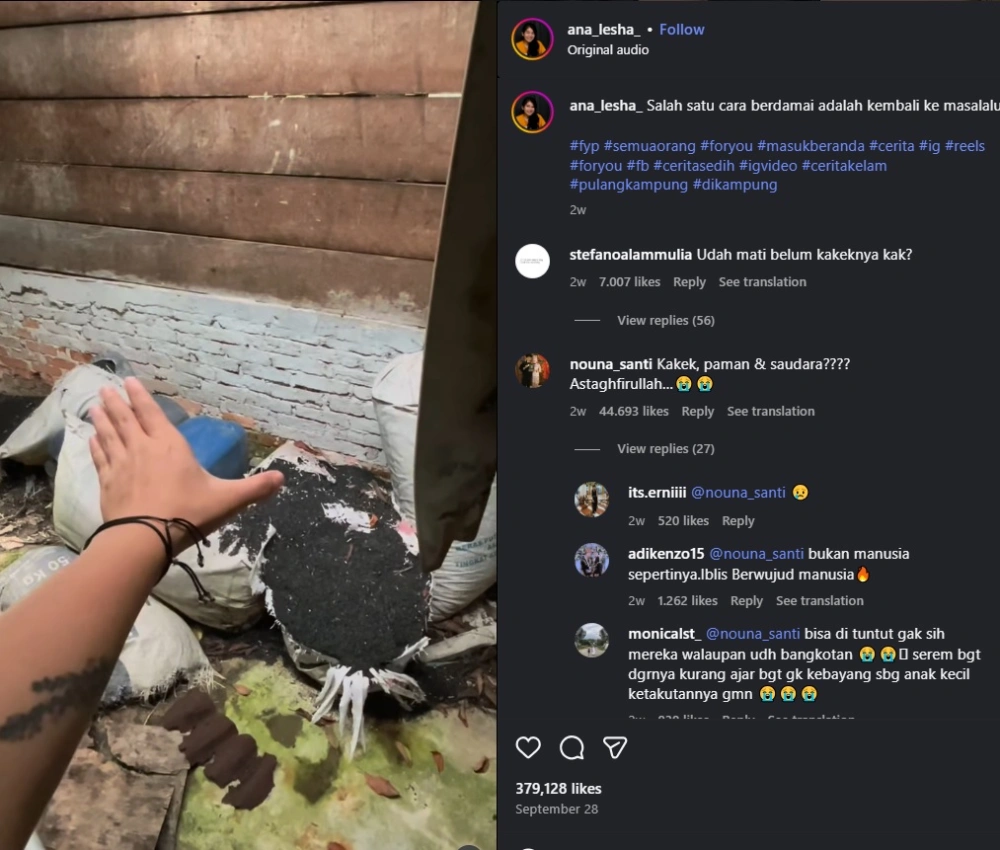 Ana Menunjukkan Lokasi Dirinya Dilecehkan Oleh Pamannya Cr Instagram Ana Lesha