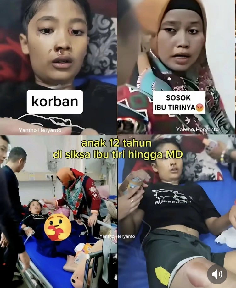 Anak Di Sukabumi Jadi Korban Siksaan Ibu Tiri Hingga Meninggal [Tiktok]