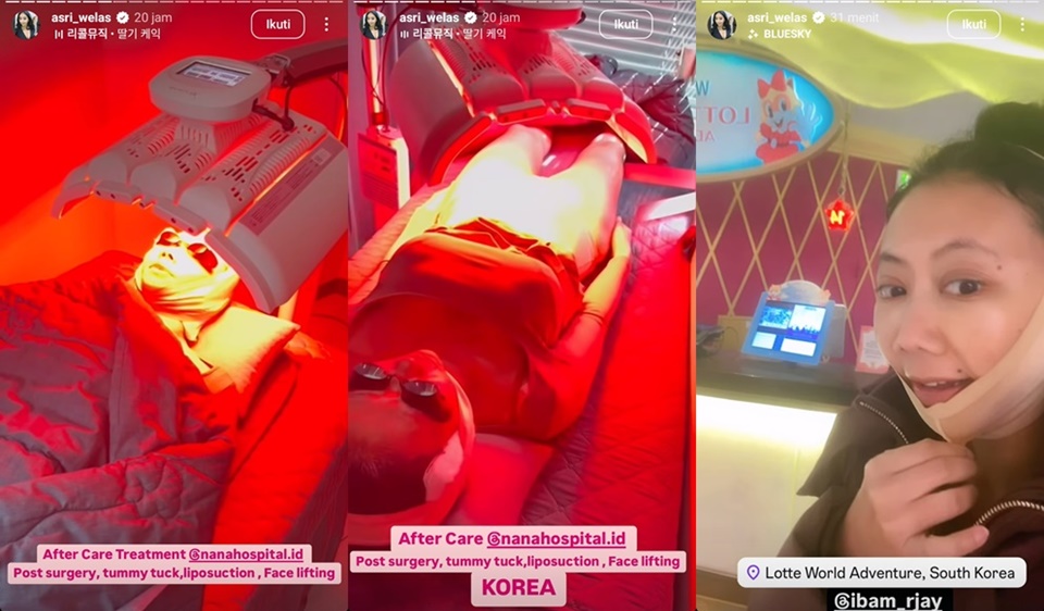 Asri Welas Oplas ke Korea Selatan [Instagram]