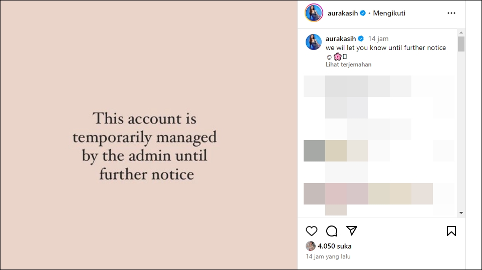 Aura Kasih Ragu-Ragu Mau Oplas Hidung, Alasannya...