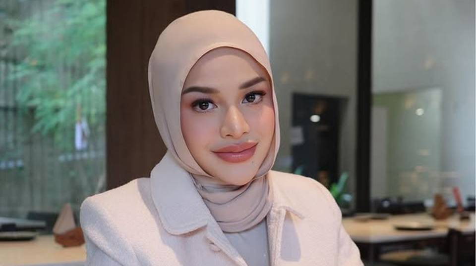Aurel Hermansyah Balas Menohok Dibilang Bibirnya Tambah Gede: Padahal B Aja...