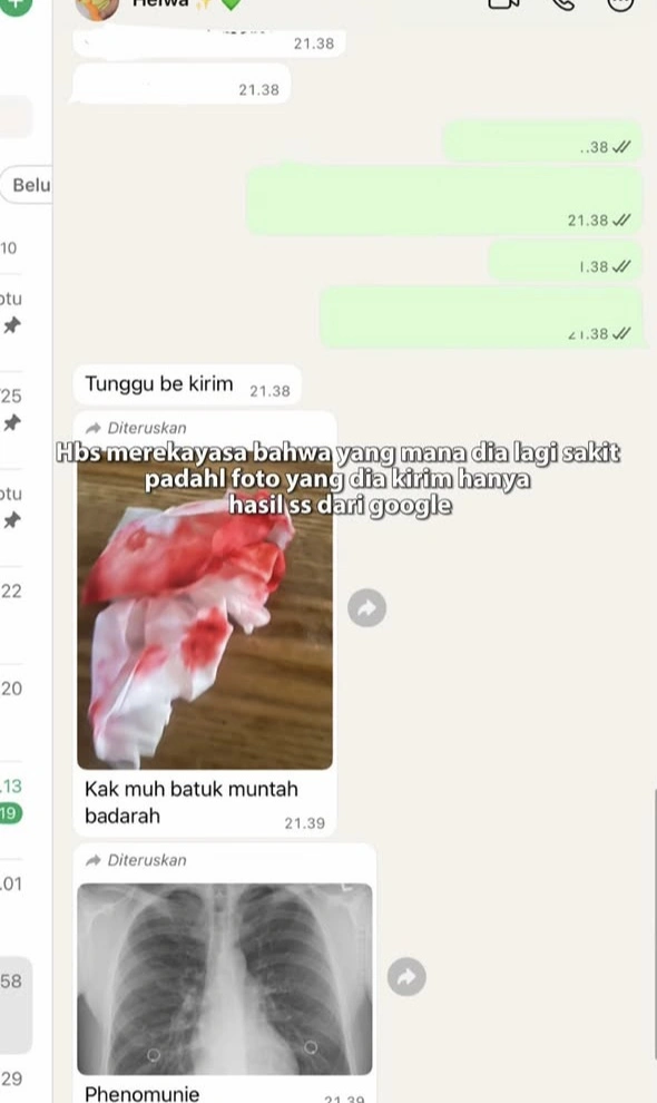 Bahar Bin Smith Muntah Darah Yang Diragukan Oleh Sultan Bachmid (Instagram)