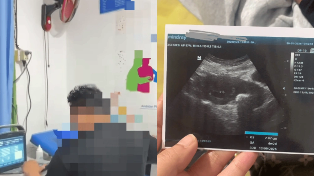 Bukti Foto Hasil Usg Yang Dibagikan Korban [Sumber: Tiktok]