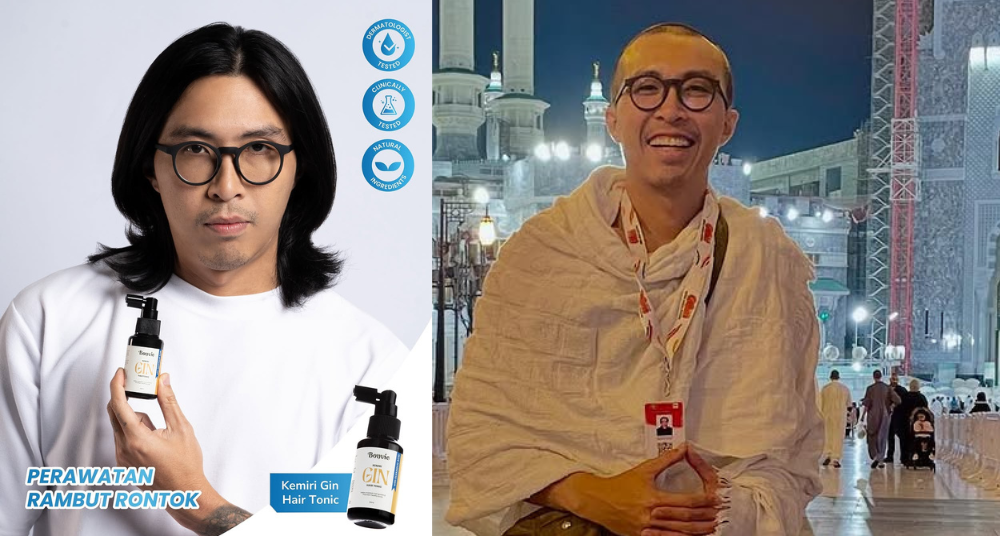 Dokter Tirta Jadi Brand Ambassador Produk Hair Care eh Pas Umrah Gundul