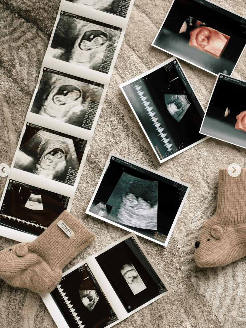 Chelsea Islan umumkan kehamilan di hari ulang tahun Rob Clinton Cardinal sang suami. [Instagram]