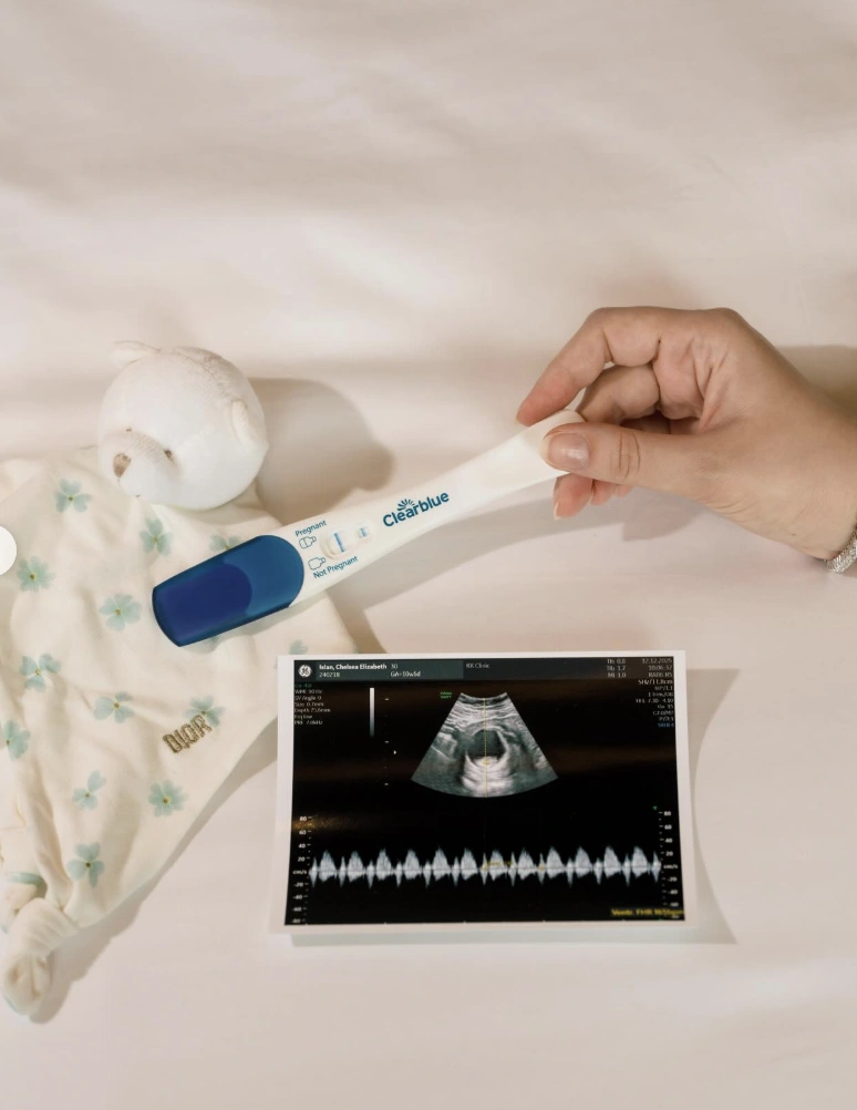 Chelsea Islan umumkan kehamilan di hari ulang tahun Rob Clinton Cardinal sang suami. [Instagram]