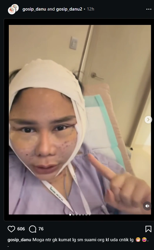 Denise Chariesta Oplas [Sumber: Instagram]