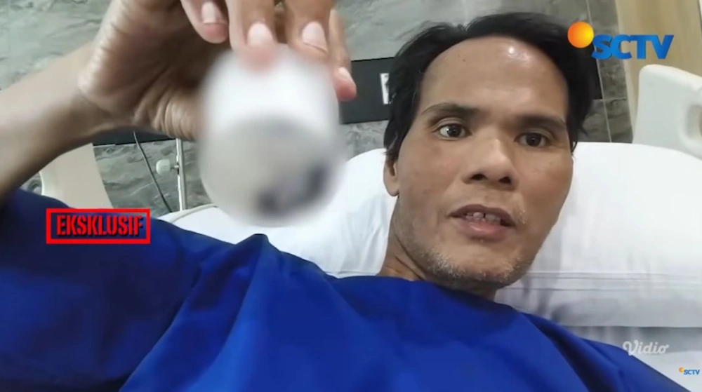 Fahmi Bo Usai Operasi Batu Empedu Youtube Youtube Surya Citra Televisi Sctv