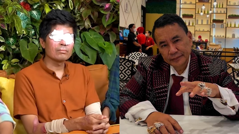 Hotman Paris Nilai Agus Salim Tak Tahu Diri, Singgung Pengacara Nebeng