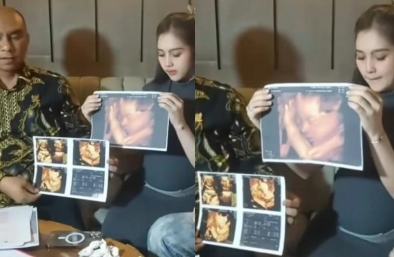 Icel Saat Menunjukkan Hasil Usg Janin Yang Dikandungnya Instagram