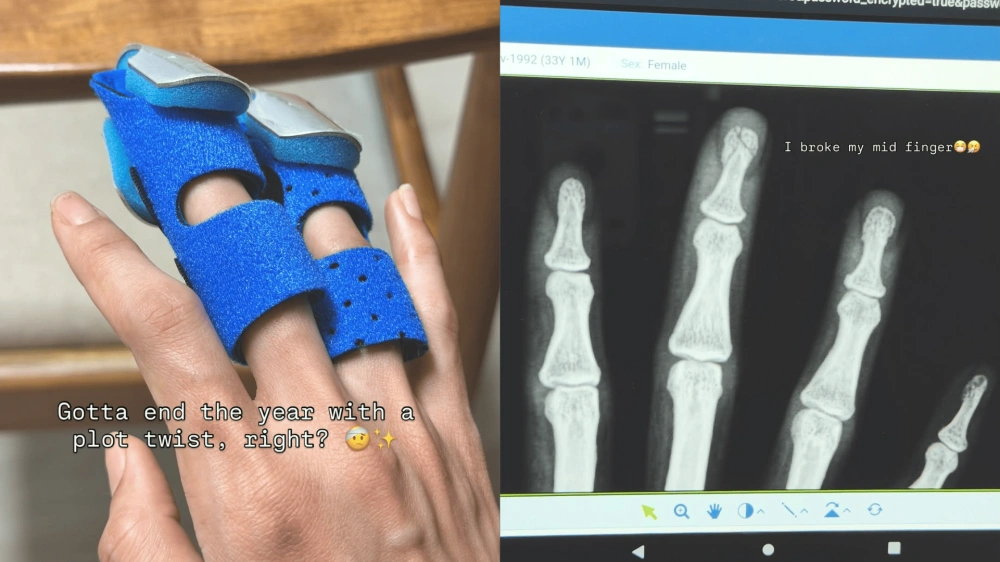 Jari Retak Jelang 2026 Sabrina Chairunnisa Dilarikan Ke Rumah Sakit [Sumber: Instagram]