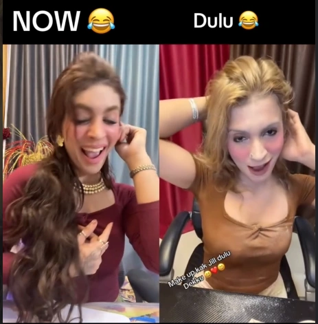 Kak Jill Dulu Dan Sekarang [Sumber: Instagram]