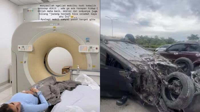 Kecelakaan Yang Dialami Diva Siregar I[nstagram]