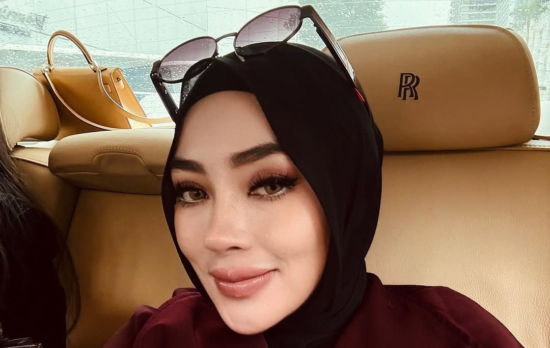 Klarifikasi Shella Saukia soal Tempel Brand Umama, Sebut Kisah Lama Dikorek Lagi!