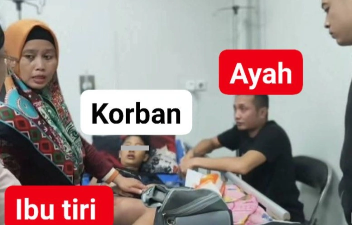 Kondisi Remaja Di Sukabumi Diduga Meninggal Dunia Usai Dianiaya Ibu Tiri [Sumber: Instagram]