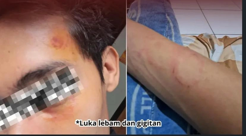 Korban Ew Yang Dianiaya Rs Instagram