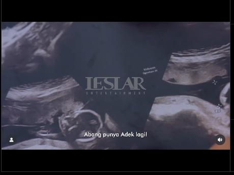 Lesti Kejora Hamil Anak Ketiga